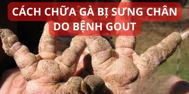 Theo chuyên gia, nguyên nhân của tình trạng này là mắc bệnh Gout